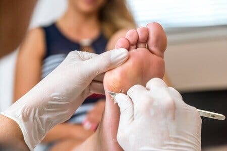 Callus Care 2025: Tips for Smoother, Healthier Feet Callus Care