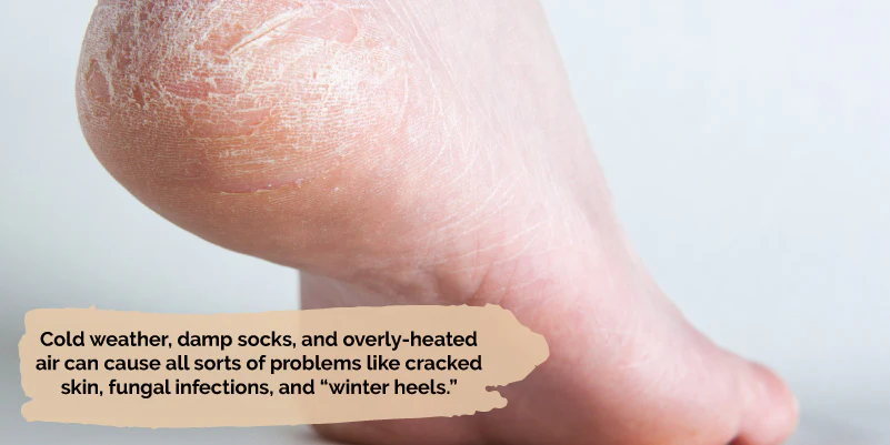 Essential Winter Foot Care: Tips for Sports and Outdoor Activities (Guide 2025) Winter Foot Care