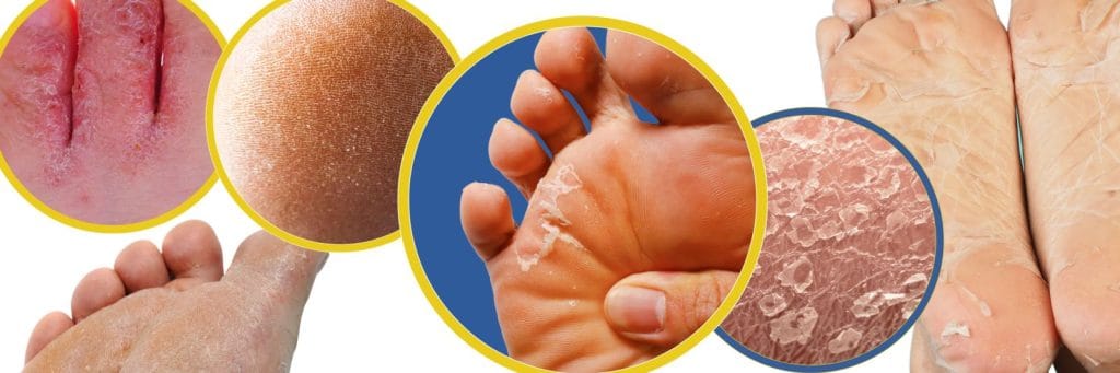 Foot Buffing: 7 Easy Steps for Silky-Smooth Soles Foot Buffing